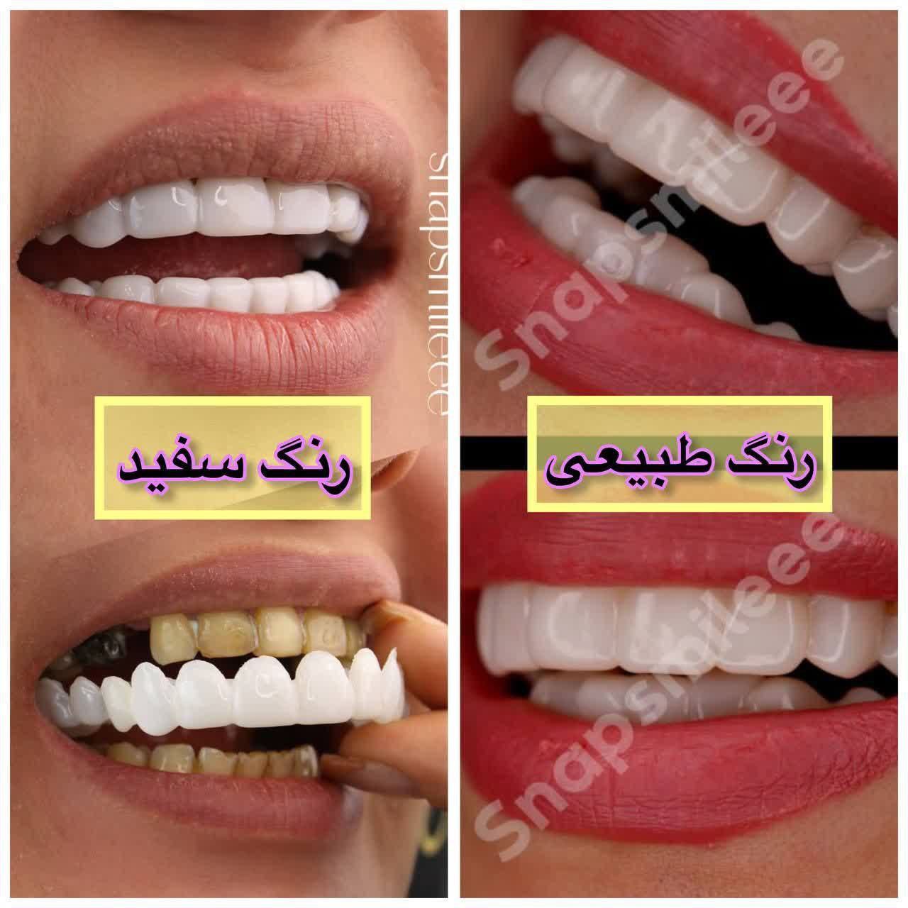 اسنپ اسمایل رنگ صدفی شرکتی تایوانی به همراه جایزه 200 تومانی